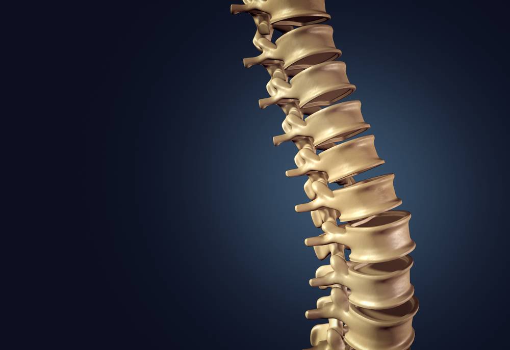 Spinal Cord Injury Lawyer in Union City | Free Consultations