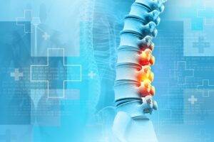 What Is a Spinal Cord Injury?